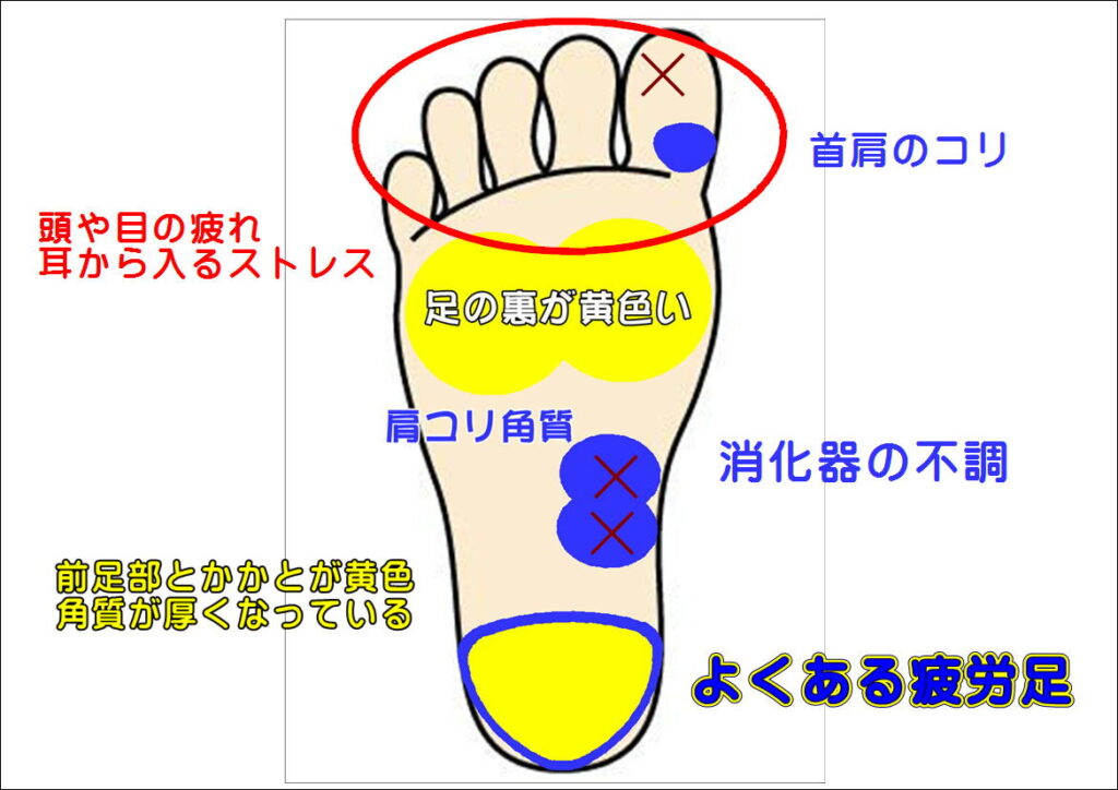 よくある疲労足