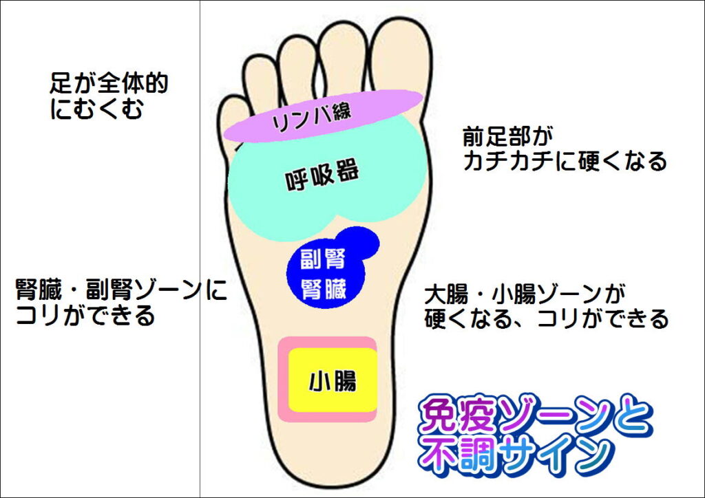 足裏の免疫ゾーンと不調サイン