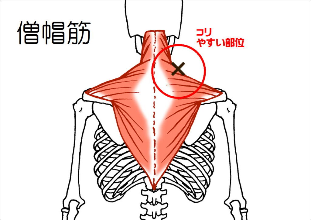 僧帽筋のコリ