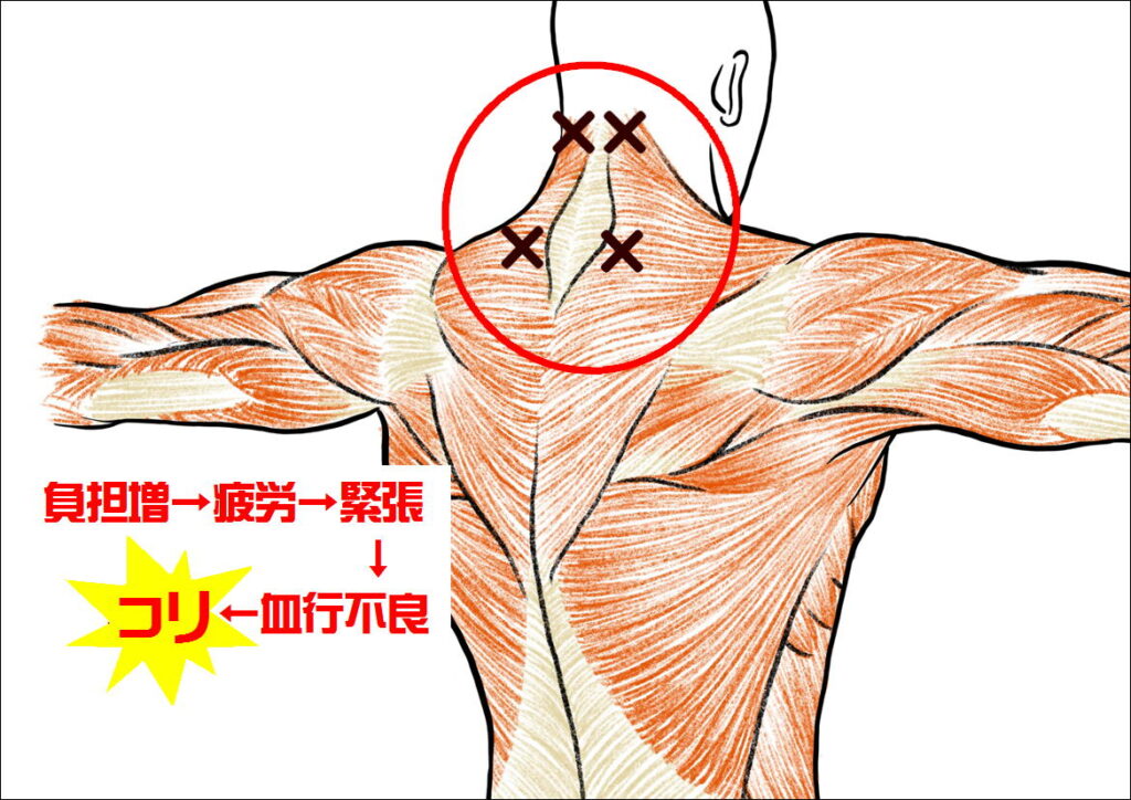 うつむき姿勢でコる部位