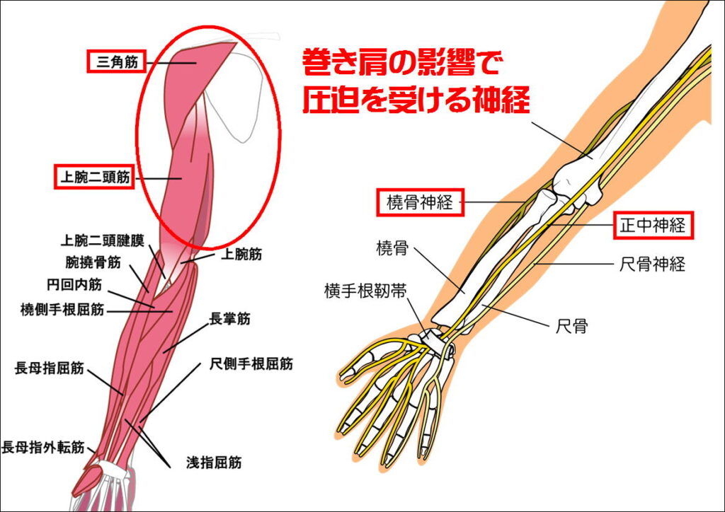 巻き肩の影響で圧迫を受ける神経