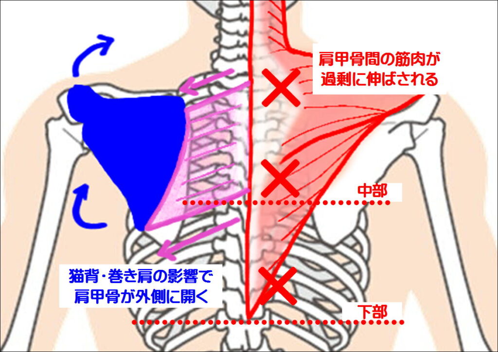 巻き肩の影響