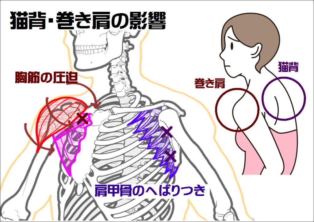 猫背巻き肩の影響