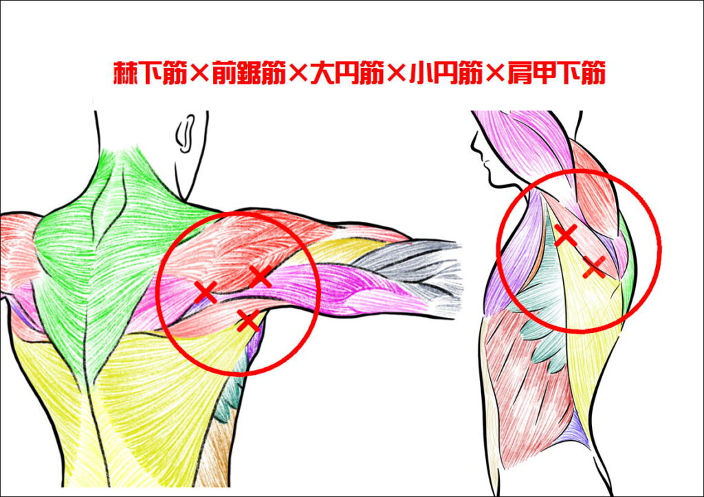 回旋筋腱板のコリ