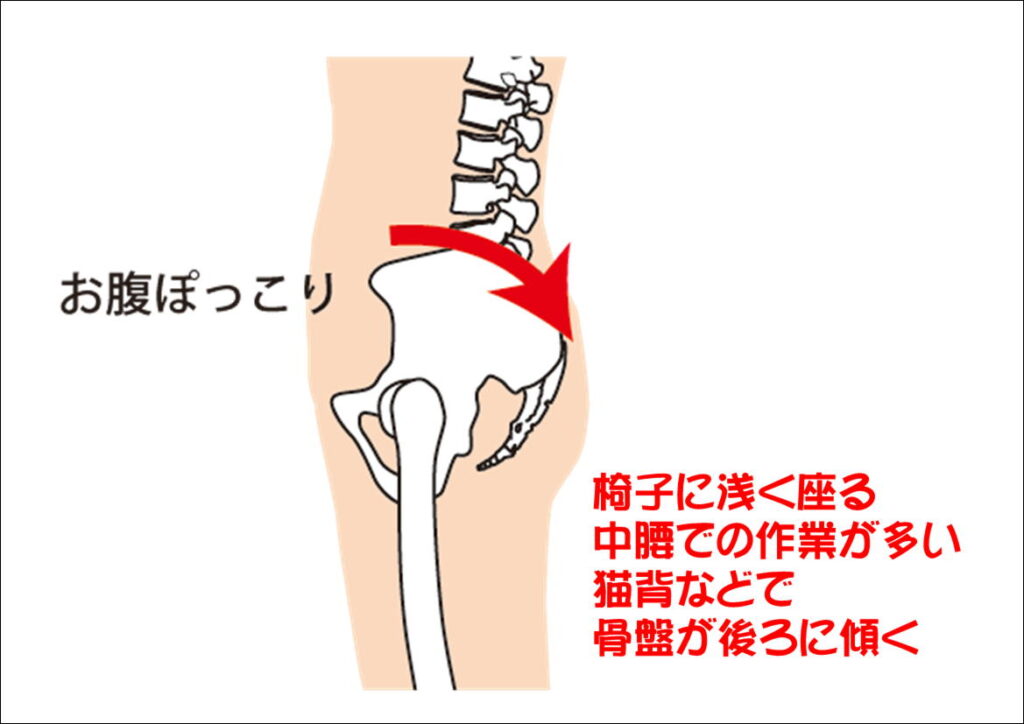 骨盤の後傾